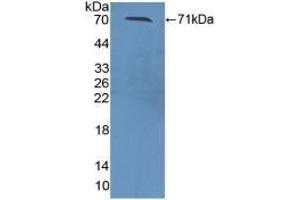 Detection of Recombinant ZPI, Mouse using Polyclonal Antibody to Serpin A10 (SERPINA10)