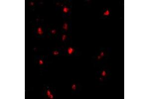 Immunofluorescence of CBL in human lymph node tissue with CBL polyclonal antibody  at 20 ug/mL .