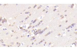 Detection of LRDD in Mouse Cerebrum Tissue using Polyclonal Antibody to Leucine Rich Repeats And Death Domain Containing Protein (LRDD) (Leucine Rich Repeats And Death Domain Containing Protein (AA 666-915) 抗体)