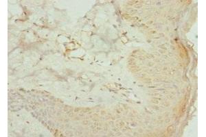 Immunohistochemistry of paraffin-embedded human skin tissue using ABIN7142022 at dilution of 1:100 (AGPAT2 抗体  (AA 199-278))