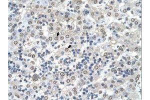 Image no. 1 for anti-Cerebellar Degeneration-Related Protein 2, 62kDa (CDR2) (N-Term) antibody (ABIN321833) (CDR2 抗体  (N-Term))