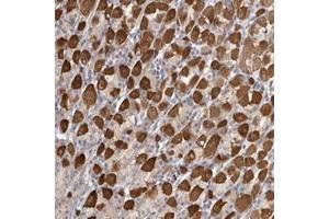 Immunohistochemical staining of human stomach with SRD5A3 polyclonal antibody  shows strong cytoplasmic positivity in subset of glandular cells. (SRD5A3 抗体)