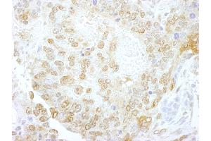 Immunohistochemistry (IHC) image for anti-Nuclear Cap Binding Protein Subunit 1, 80kDa (NCBP1) (AA 482-532) antibody (ABIN7448681)
