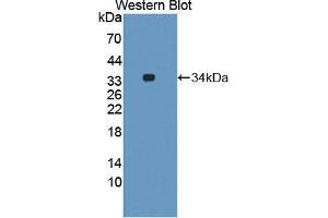 Western blot analysis of the recombinant protein. (GRK6 抗体  (AA 186-448))