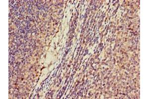 Immunohistochemistry of paraffin-embedded human lymph node tissue using ABIN7157644 at dilution of 1:100 (KIF2A 抗体  (AA 5-308))