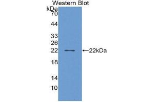 Western Blotting (WB) image for anti-Prostaglandin D2 Synthase (PTGDS) (AA 32-190) antibody (ABIN1869787) (PTGDS 抗体  (AA 32-190))