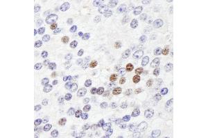 Immunohistochemistry (IHC) image for anti-Zinc Fingers and Homeoboxes 3 (ZHX3) (AA 150-200) antibody (ABIN7449040)