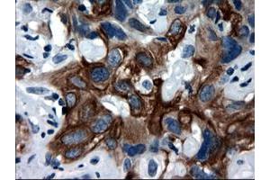 Image no. 2 for anti-Keratin 18 (KRT18) (AA 69-372) antibody (ABIN1491637) (Cytokeratin 18 抗体  (AA 69-372))