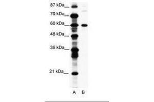 Image no. 1 for anti-CCR4-NOT Transcription Complex, Subunit 3 (CNOT3) (AA 141-190) antibody (ABIN203225) (CNOT3 抗体  (AA 141-190))