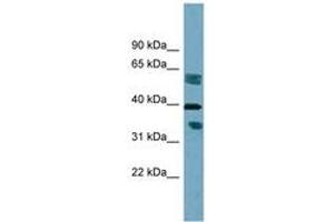 Image no. 1 for anti-Dehydrogenase/reductase (SDR Family) Member 7B (DHRS7B) (AA 215-264) antibody (ABIN6742028) (DHRS7B 抗体  (AA 215-264))