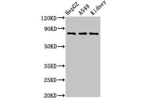 Western Blot Positive WB detected in: HepG2 whole cell lysate, A549 whole cell lysate, Rat kidney tissue All lanes: UIMC1 antibody at 3 μg/mL Secondary Goat polyclonal to rabbit IgG at 1/50000 dilution Predicted band size: 80, 62, 71, 39, 18 kDa Observed band size: 80 kDa (UIMC1 抗体  (AA 161-235))