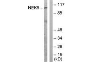 Western Blotting (WB) image for anti-NIMA (Never in Mitosis Gene A)- Related Kinase 9 (NEK9) (AA 176-225) antibody (ABIN2888914) (NEK9 抗体  (AA 176-225))