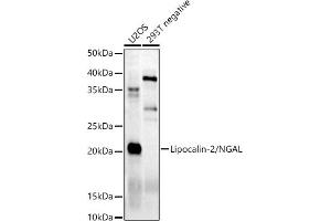 Western blot analysis of extracts of various cell lines, using Lipocalin-2/NGAL antibody (ABIN6128177, ABIN6143114, ABIN6143115 and ABIN6215076) at 1:500 dilution. (Lipocalin 2 抗体)