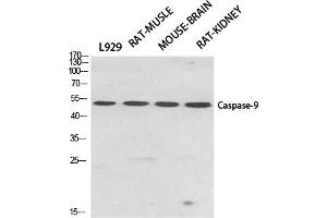 Western Blotting (WB) image for anti-Caspase 9, Apoptosis-Related Cysteine Peptidase (CASP9) (Thr125) antibody (ABIN5960804) (Caspase 9 抗体  (Thr125))