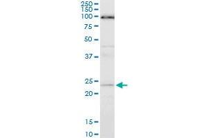 ATG5 monoclonal antibody (M05), clone 1E7. (ATG5 抗体  (AA 176-275))