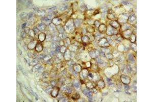 Immunohistochemistry (IHC) image for anti-Caspase 6, Apoptosis-Related Cysteine Peptidase (CASP6) (AA 24-44) antibody (ABIN3030313)