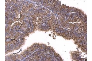 IHC-P Image GNAQ antibody detects GNAQ protein at cytosol on mouse prostate by immunohistochemical analysis. (GNAQ 抗体  (Center))