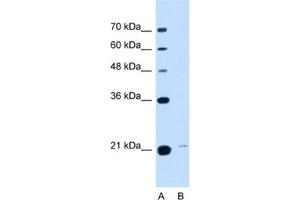 Western Blotting (WB) image for anti-Transmembrane Emp24 Protein Transport Domain Containing 3 (TMED3) antibody (ABIN2463022) (TMED3 抗体)