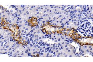 Detection of CK5 in Rat Kidney Tissue using Polyclonal Antibody to Cytokeratin 5 (CK5) (Cytokeratin 5 抗体  (AA 335-473))