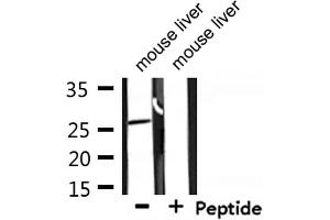Western blot analysis of extracts from mouse brain, using GADD153 Antibody.