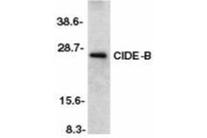 Western blot analysis of CIDE-B in mouse liver tissue lysate with AP30231PU-N CIDE-B antibody at 1/500 dilution. (CIDEB 抗体  (C-Term))