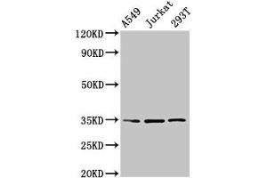 Western Blot Positive WB detected in: A549 whole cell lysate, Jurkat whole cell lysate, 293T whole cell lysate All lanes: MAGEA3 antibody at 4 μg/mL Secondary Goat polyclonal to rabbit IgG at 1/50000 dilution Predicted band size: 35 kDa Observed band size: 35 kDa (MAGEA3 抗体  (AA 2-104))