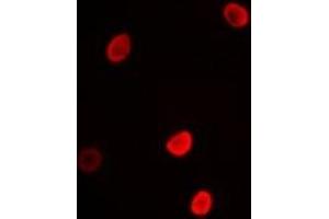 Immunofluorescent analysis of L3MBTL3 staining in MCF7 cells. (L3MBTL3 抗体)