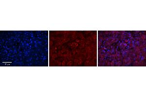 Rabbit Anti-GGCX Antibody      Formalin Fixed Paraffin Embedded Tissue: Human Adult Liver   Observed Staining: Cytoplasm in hepatocytes, strong signal, wide tissue distribution  Primary Antibody Concentration: 1:100  Secondary Antibody: Donkey anti-Rabbit-Cy3  Secondary Antibody Concentration: 1:200  Magnification: 20X  Exposure Time: 0. (GGCX 抗体  (Middle Region))