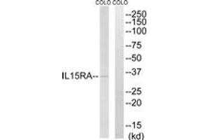 Western blot analysis of extracts from COLO cells, using IL15RA Antibody.
