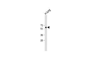 Anti-SD6 Antibody (Center) at 1:500 dilution + H. (SMAD6 抗体  (AA 358-386))