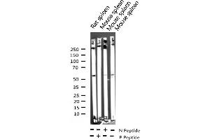 Western blot analysis of Phospho-Lck (Tyr393) expression in various lysates (LCK 抗体  (pTyr393))