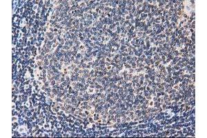 Image no. 8 for anti-Striatin Interacting Protein 1 (STRIP1) antibody (ABIN1498205) (STRIP1 抗体)