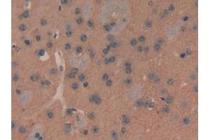Immunohistochemistry (IHC) image for anti-ATPase, Ca++ Transporting, Plasma Membrane 2 (ATP2B2) (AA 417-830) antibody (ABIN7436264)