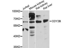 Western blot analysis of extracts of various cell lines, using CDY2B antibody (ABIN6292882) at 1:3000 dilution.