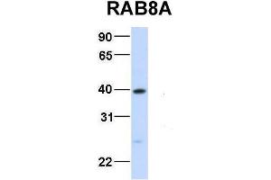 Host:  Rabbit  Target Name:  RAB8A  Sample Type:  Human Fetal Liver  Antibody Dilution:  1. (RAB8A 抗体  (Middle Region))