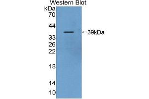 Western blot analysis of the recombinant protein. (SBEM 抗体  (AA 21-90))