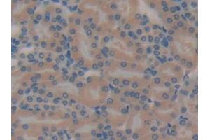 Immunohistochemistry (IHC) image for anti-Pyruvate Dehydrogenase Kinase, Isozyme 2 (PDK2) (AA 155-379) antibody (ABIN7439423)