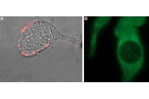 Immunocytochemistry (ICC) image for anti-Transient Receptor Potential Cation Channel, Subfamily M, Member 8 (TRPM8) (AA 917-929), (Extracellular) antibody (ABIN7043837)