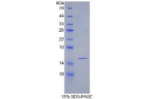 SDS-PAGE analysis of Rat SFRP5 Protein. (SFRP5 蛋白)