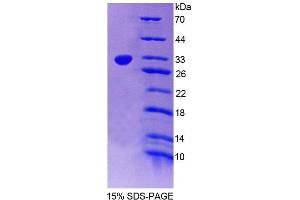 SDS-PAGE analysis of Mouse PTPN2 Protein. (PTPN2 蛋白)