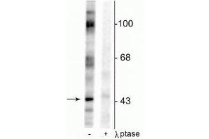 Western blot of rat testes lysate showing specific immunolabeling of the ~46 kDa EphrinB phosphorylated at Tyr317 in the first lane (-). (EPH Receptor B2 抗体  (pTyr317))