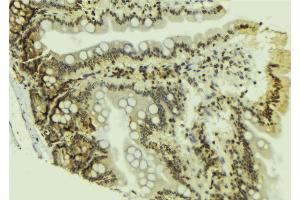 ABIN6269061 at 1/100 staining Mouse colon tissue by IHC-P. (JAK2 抗体  (N-Term))