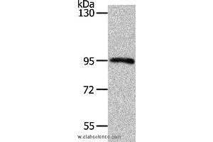 Western blot analysis of Mouse kidney tissue, using MYSM1 Polyclonal Antibody at dilution of 1:1100