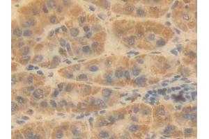 Immunohistochemistry (IHC) image for anti-Ornithine Carbamoyltransferase (OTC) (AA 78-129) antibody (ABIN7433690)