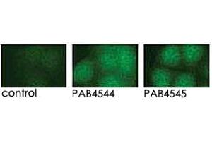 Indirect immunofluorescence analysis of GFP-PRKD3 fusion protein expression in Panc-1 cells by using PRKD3 polyclonal antibody  and PRKD3 polyclonal antibody  . (PRKD3 抗体  (Internal Region))
