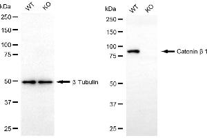 Western blotting analysis using catenin beta 1 antibody (ABIN7797928).