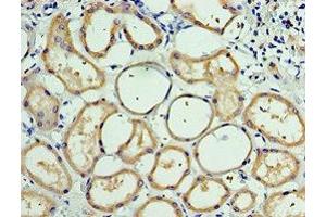 Immunohistochemistry of paraffin-embedded human kidney tissue using ABIN7146236 at dilution of 1:100 (CDH6 抗体  (AA 1-250))