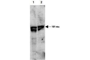 Western blot using ECT2 (phospho T790) polyclonal antibody  showsdetection of endogenous phospho-ECT2 (arrowhead) present in cell lysates from interphase (Lane 1) and mitotic (Lane 2) HeLa cells. (ECT2 抗体  (pThr790))