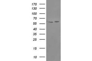 HEK293T cells were transfected with the pCMV6-ENTRY control (Left lane) or pCMV6-ENTRY PPAT (Right lane) cDNA for 48 hrs and lysed. (PPAT 抗体  (AA 42-278))