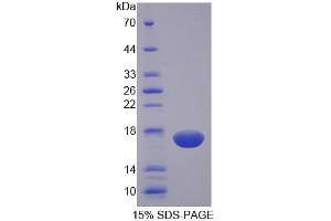 SDS-PAGE analysis of Rat NCR3 Protein. (NCR3 蛋白)
